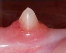 dental disease cat stage 1